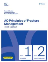 AO_principles_of_fracture_management