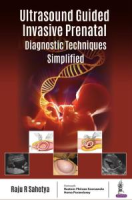 Ultrasound_guided_invasive_prenatal_diagnostic_techniques_simplified