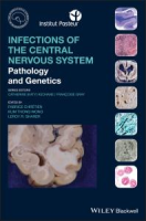 Infections_of_the_central_nervous_system