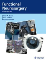 Functional_neurosurgery