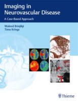 Imaging_in_neurovascular_disease