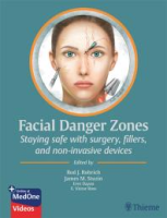 Facial_danger_zones